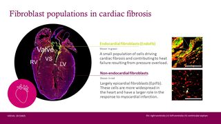 EndoFb-cardio-graphic